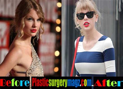 did taylor swift get breast implants|From Taylor Swift to Olivia Rodrigo, the four celebrities a top NY .